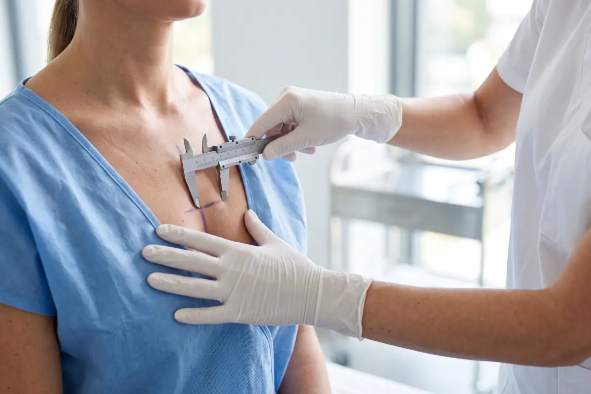 Poliklinika Beograd | Breast surgery