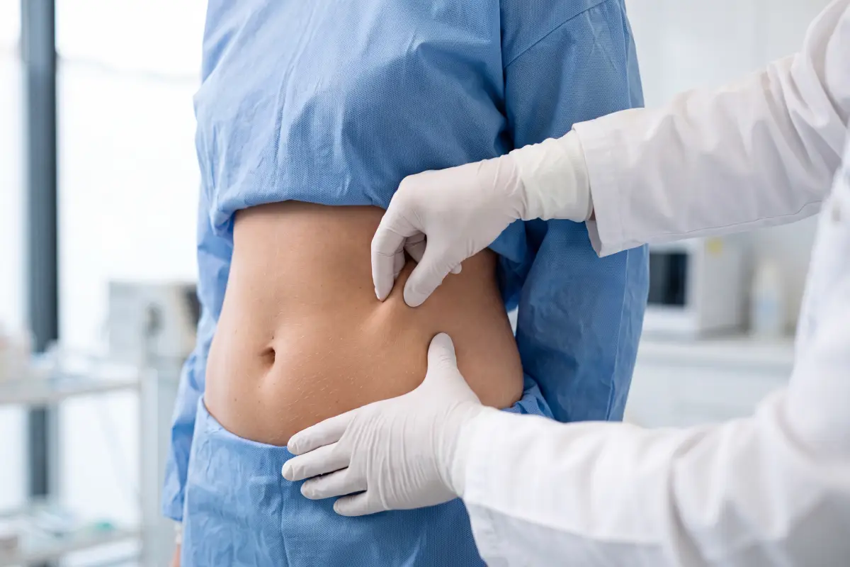 Poliklinika Beograd | Liposuction