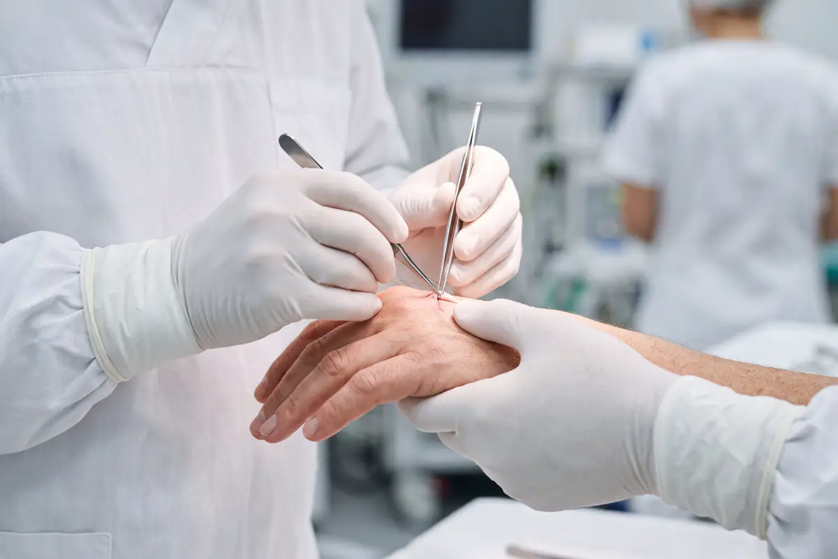 Poliklinika Beograd | Microsurgical repair of the consequences of injuries and surgeries