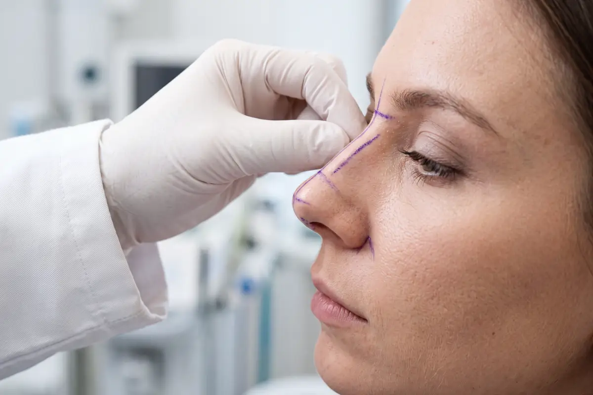 Poliklinika Beograd | Nose surgery