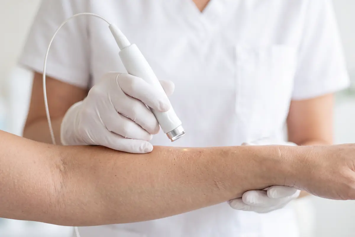 Poliklinika Beograd | Removal of stretch marks, tattoos, scars, and hemangiomas