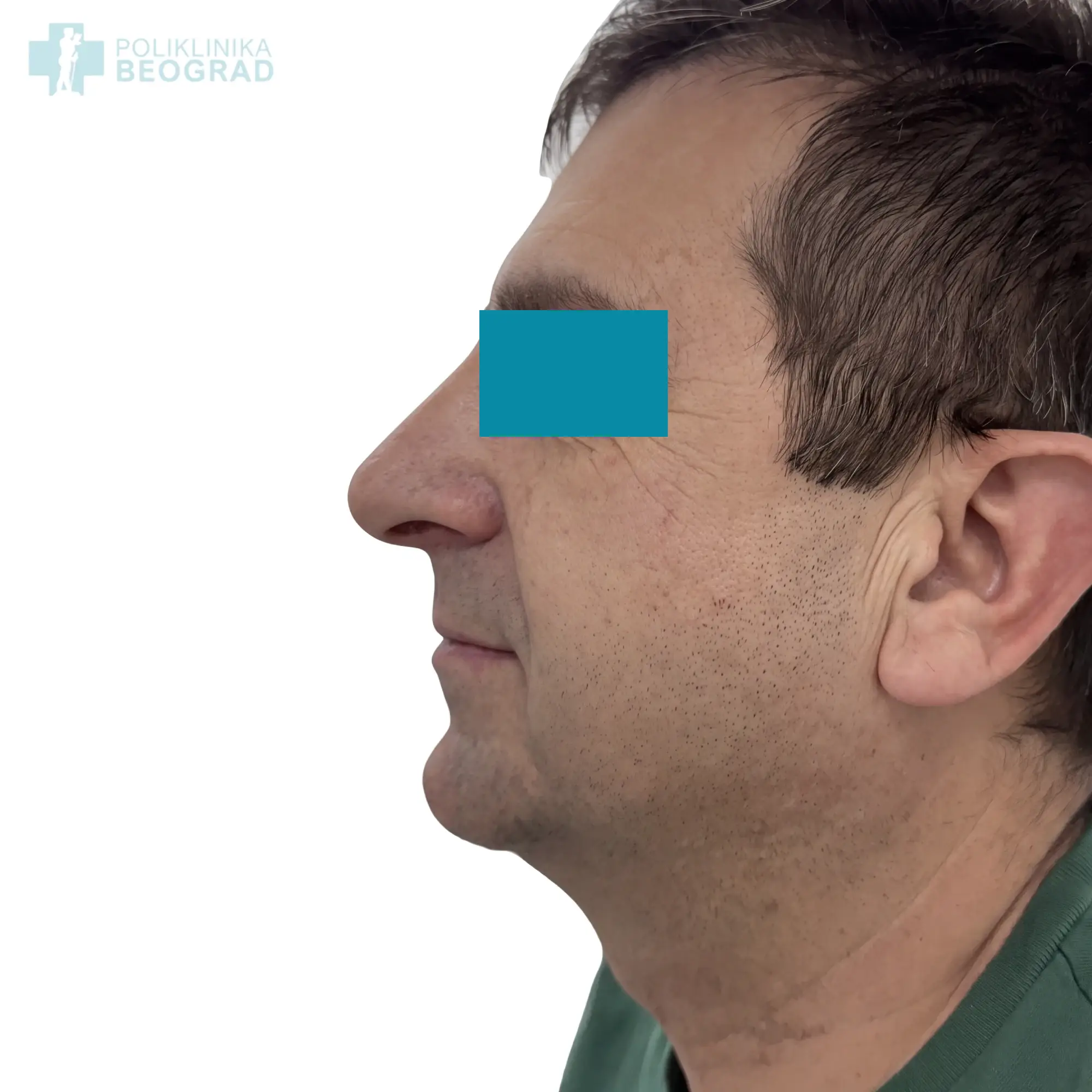 Poliklinika Beograd | Before and after
