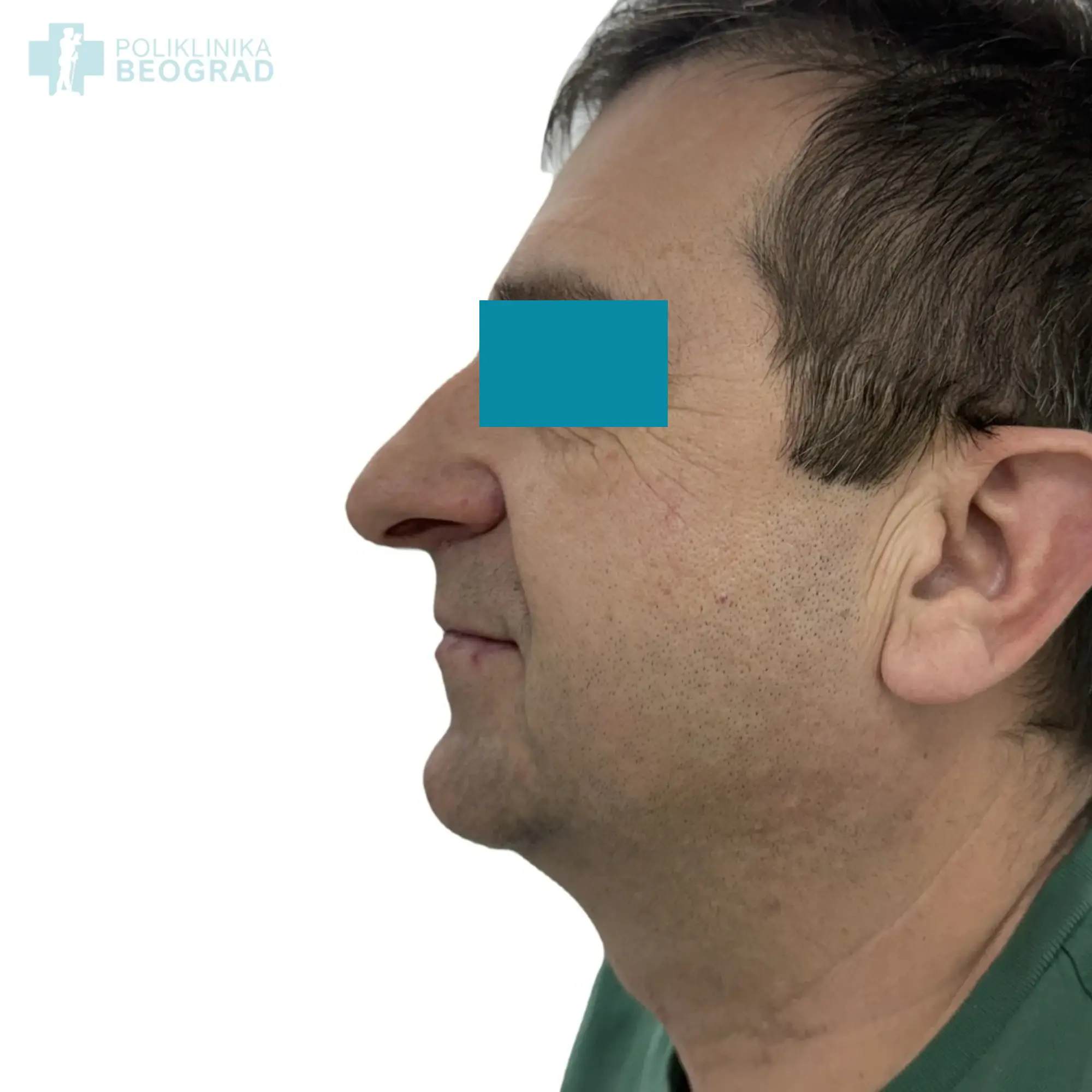 Poliklinika Beograd | Before and after