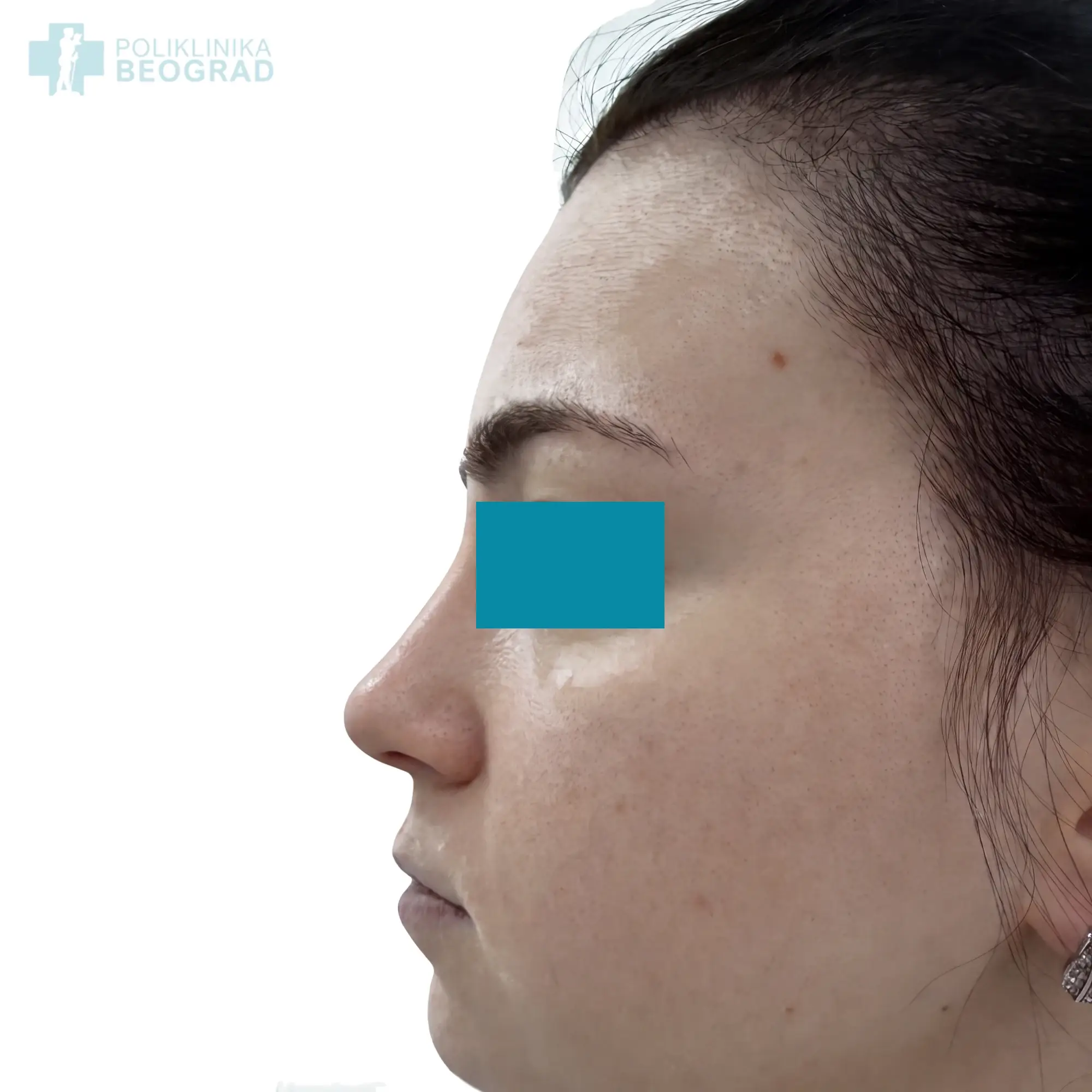 Poliklinika Beograd | Before and after