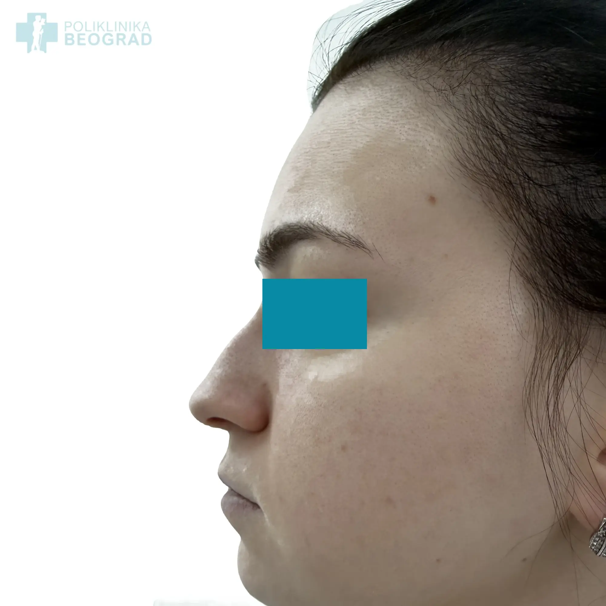 Poliklinika Beograd | Before and after