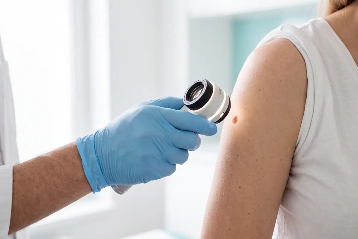 Poliklinika Beograd | Dermatovenereology