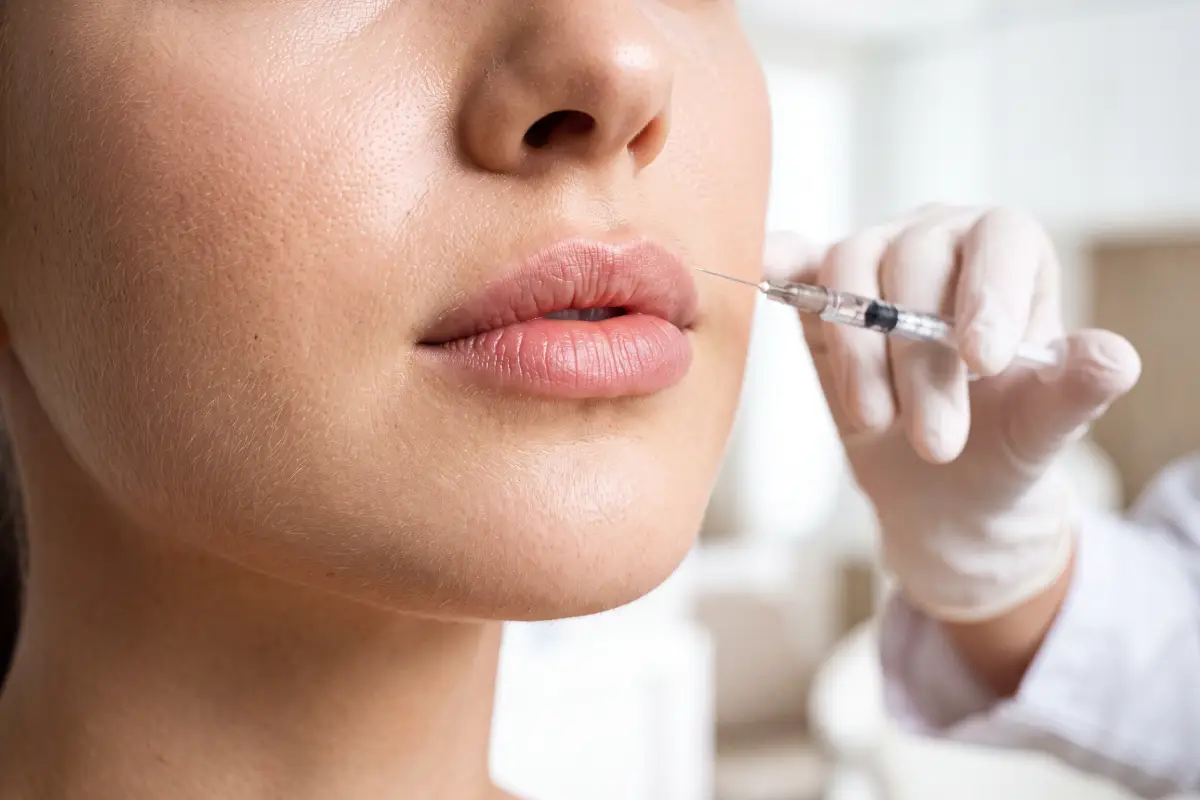 Poliklinika Beograd | Lip correction