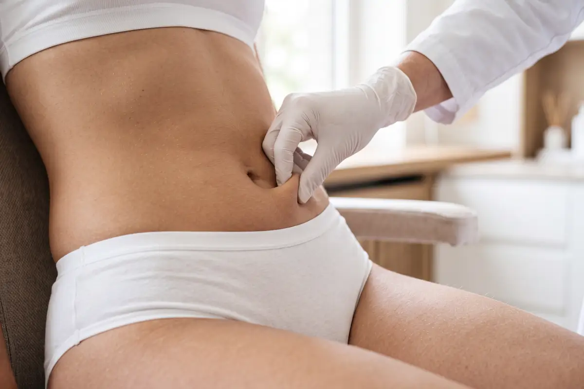 Poliklinika Beograd | Abdominoplasty