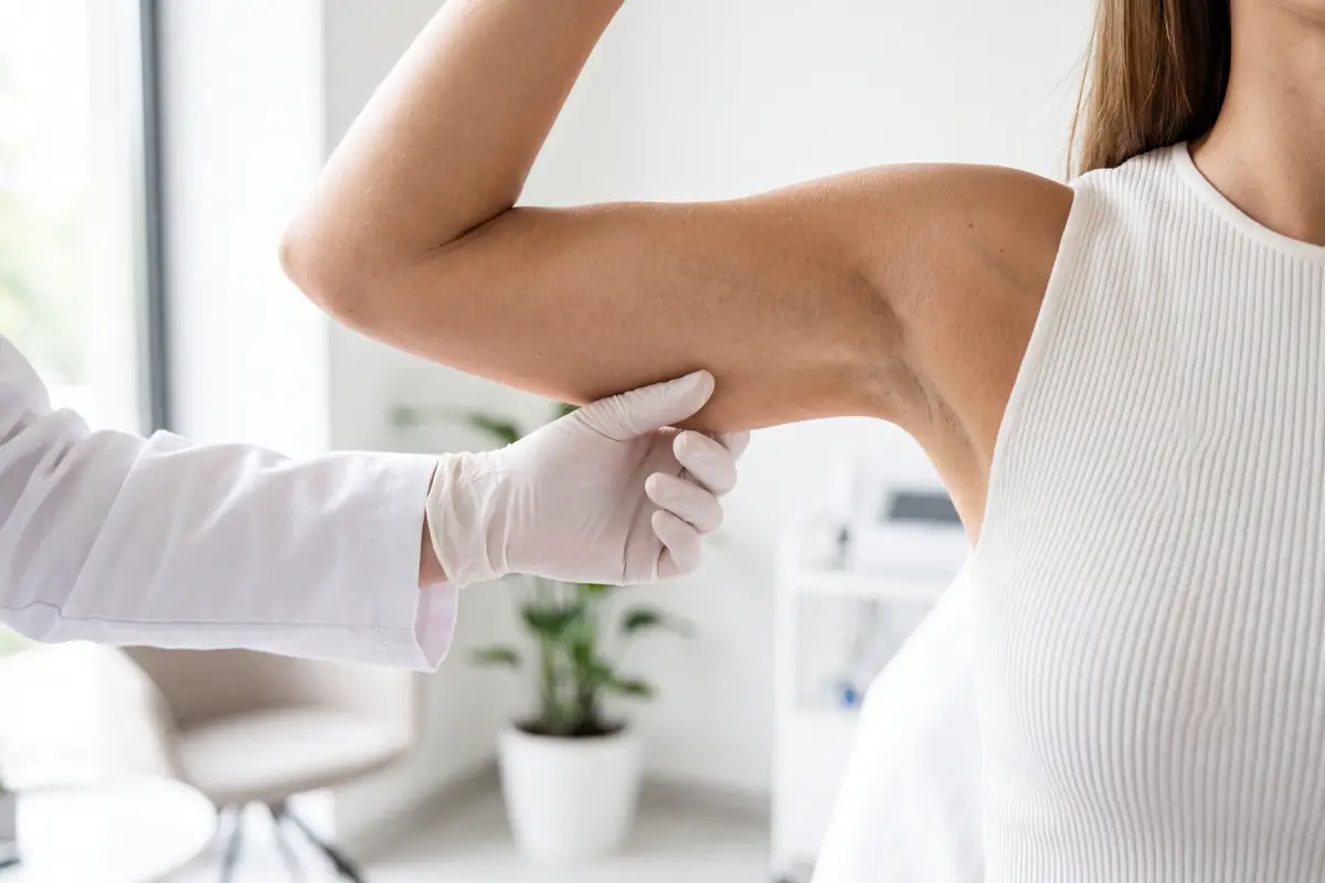 Poliklinika Beograd | Upper arm liposuction
