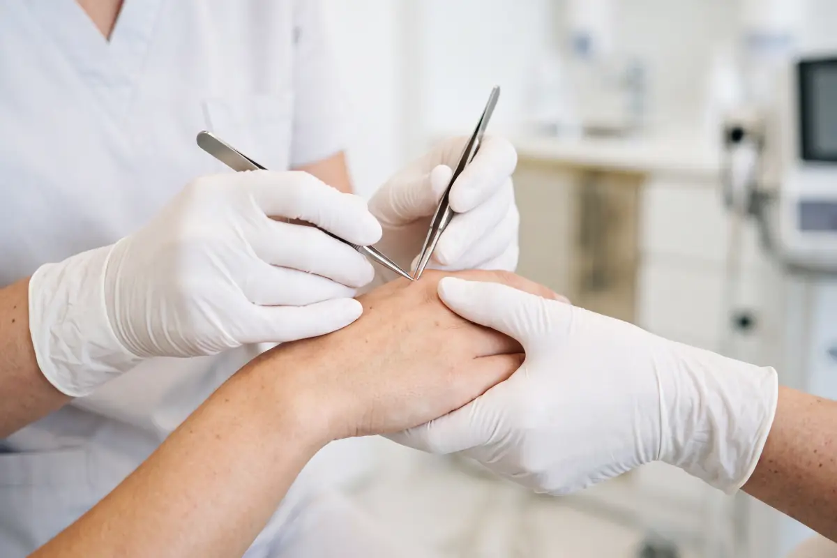 Poliklinika Beograd | Microsurgical repair of the consequences of injuries and surgeries